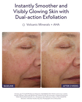 ALASTIN ReSURFACE ingredient label highlighting glycolic acid and minerals benefit