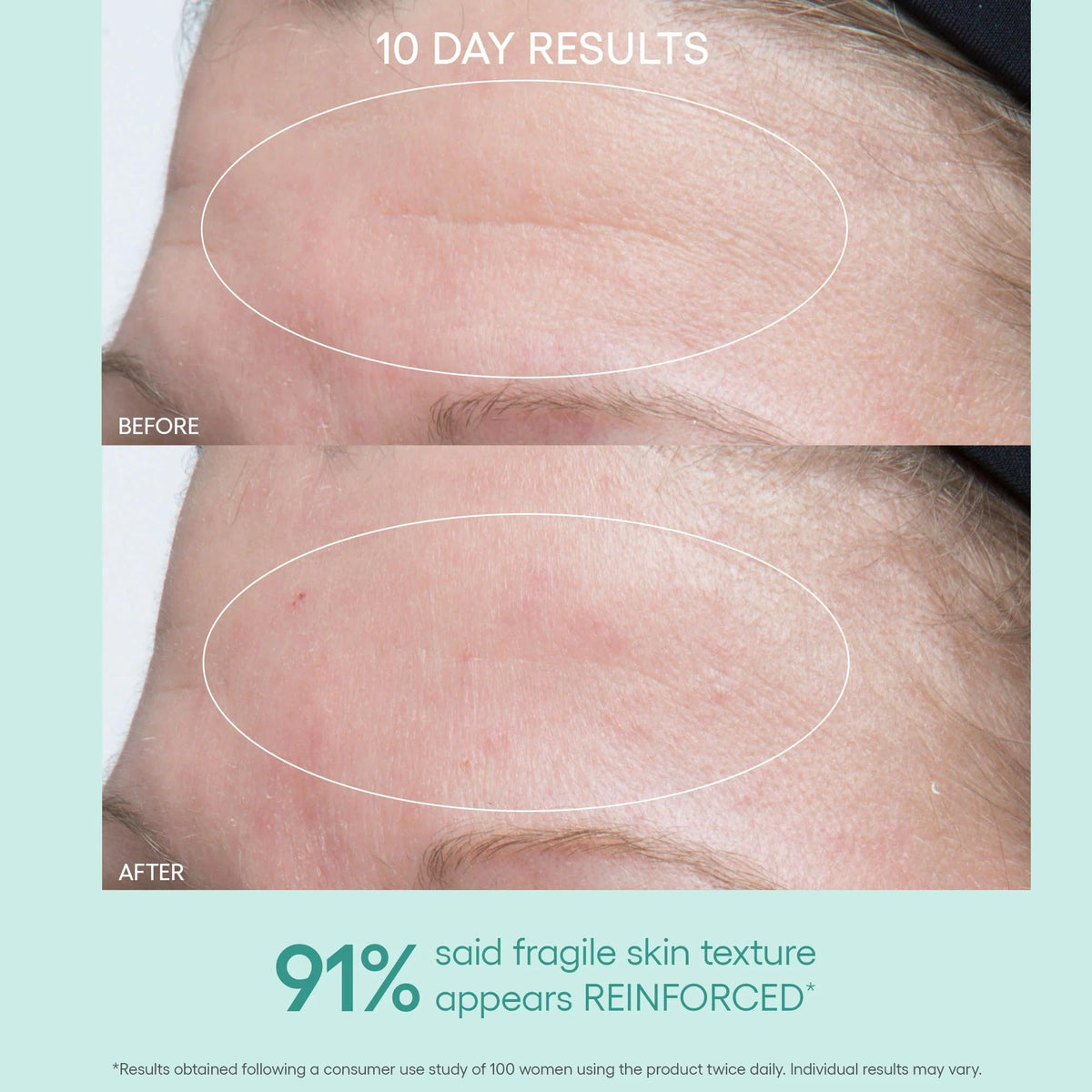 Algenist being applied to neck to improve elasticity and tone