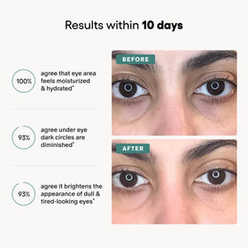Algenist eye balm before and after comparison illustrating reduced dark circles