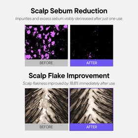 ALIVE:LAB application on scalp demonstrating targeted cleansing benefit