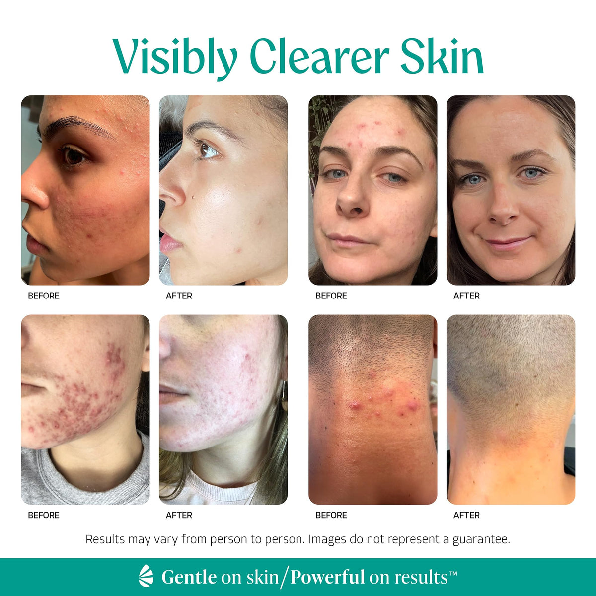 Almond Clear mandelic acid graphic highlighting ingredient and gentle exfoliation benefit