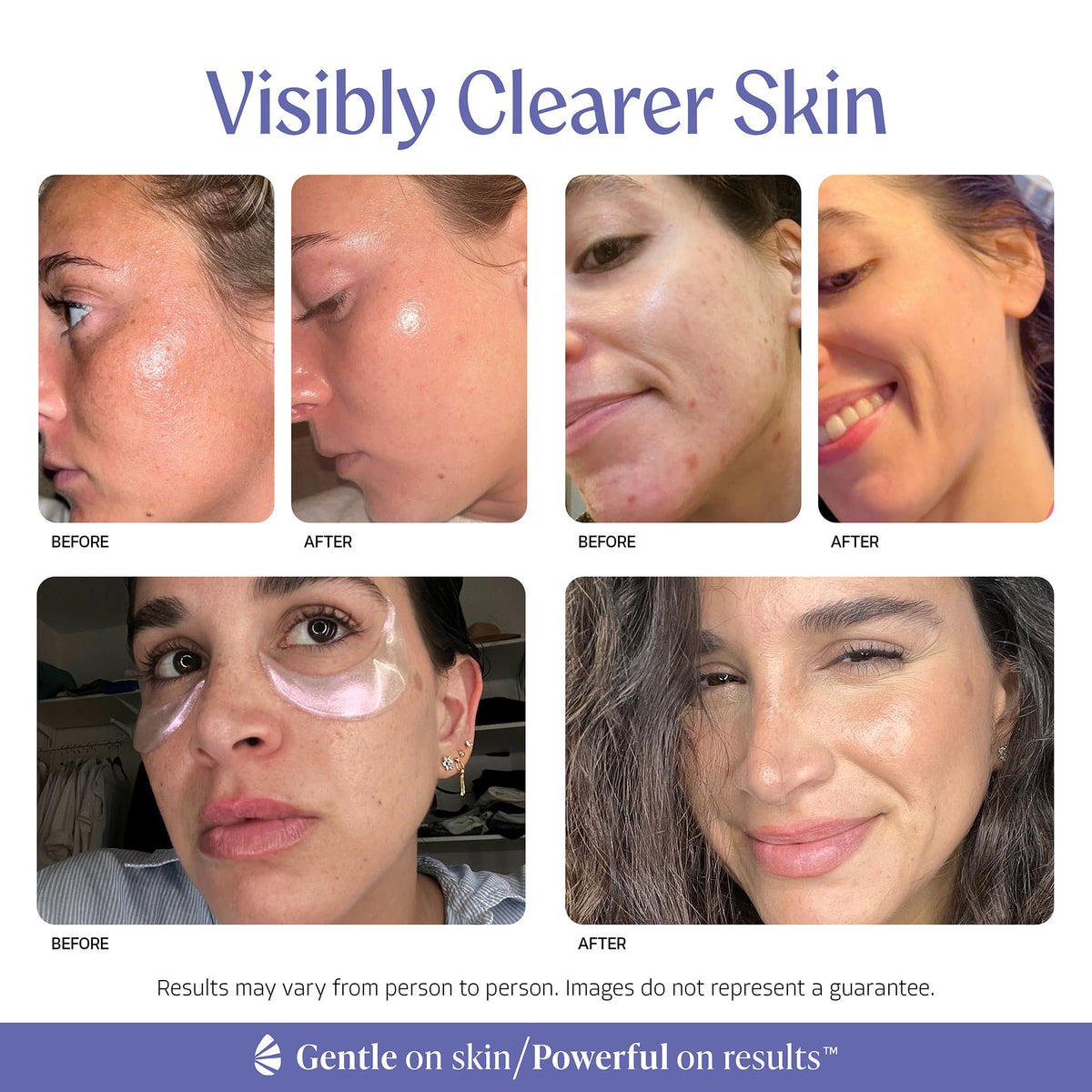 Almond Clear pump dispensing gel to show easy application and controlled dosing