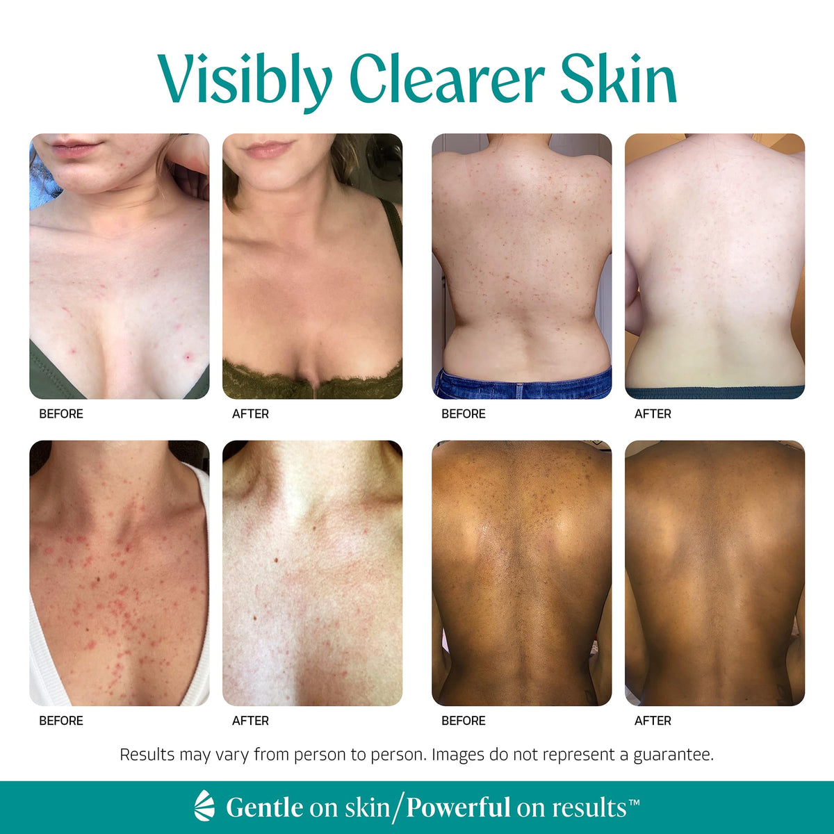 Almond Clear mandelic serum texture demonstrating lightweight absorbency benefit