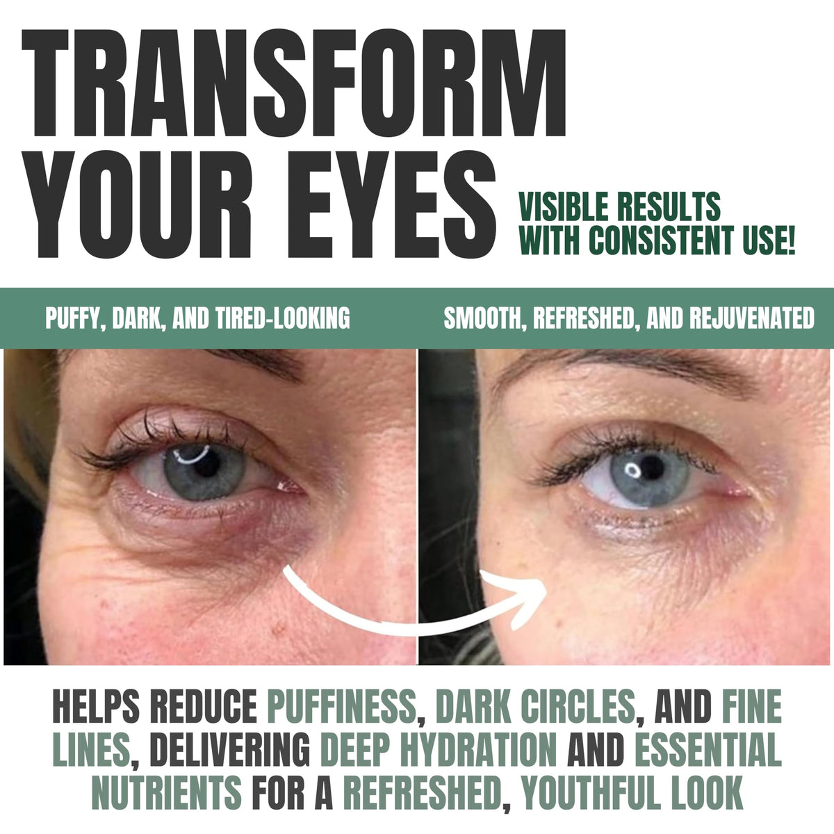 Applying Alozera under eye with fingertips, shows soothing application