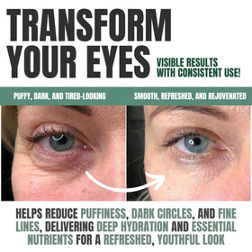 Applying Alozera under eye with fingertips, shows soothing application