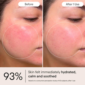 Alpyn ghostberry and Tasmanian pepper ingredients highlighting soothe action
