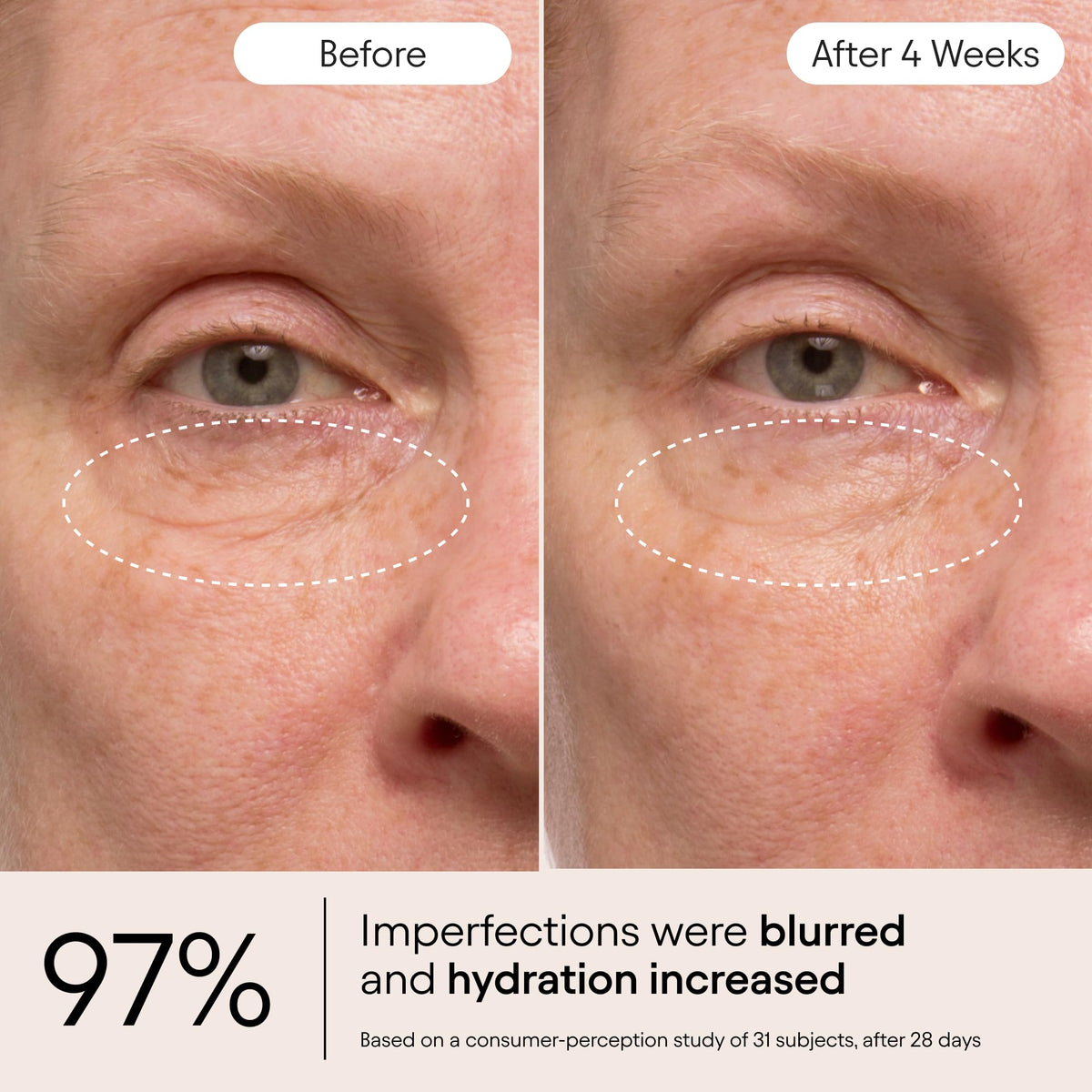 Alpyn Instant Bright Eye open tube dispenser with product dispensed — highlights easy application