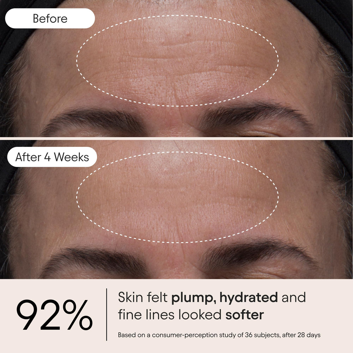 Alpyn product on hand being spread for quick absorption and hydration