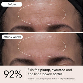Alpyn product on hand being spread for quick absorption and hydration
