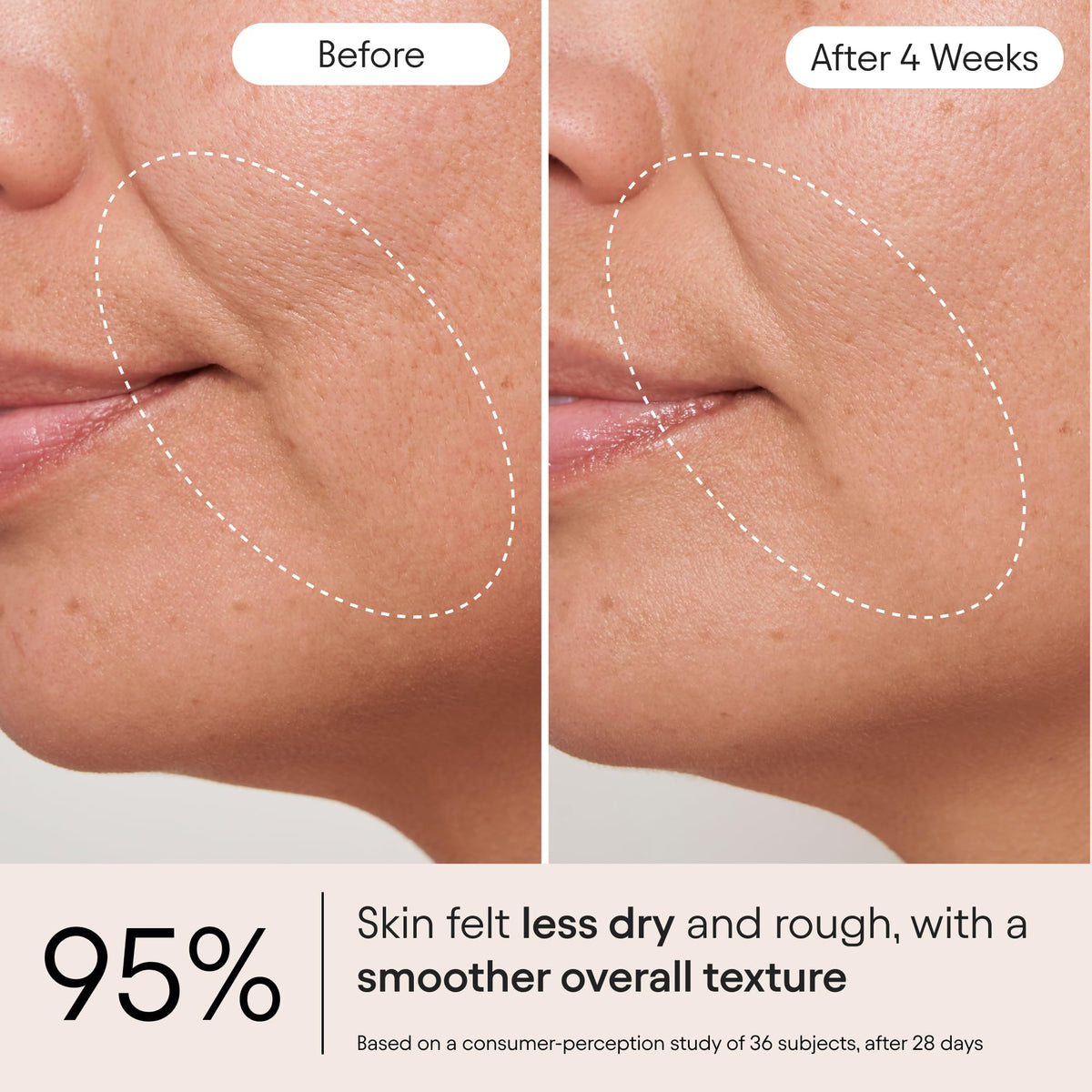 Alpyn moisturizer beside hyaluronic acid droplet showing hydration boost
