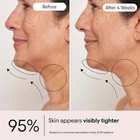 Alpyn Beauty serum being applied to neck, supports lifting and smoothing