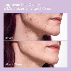 Alpyn close-up of clear liquid texture pouring, highlights gentle exfoliation benefit