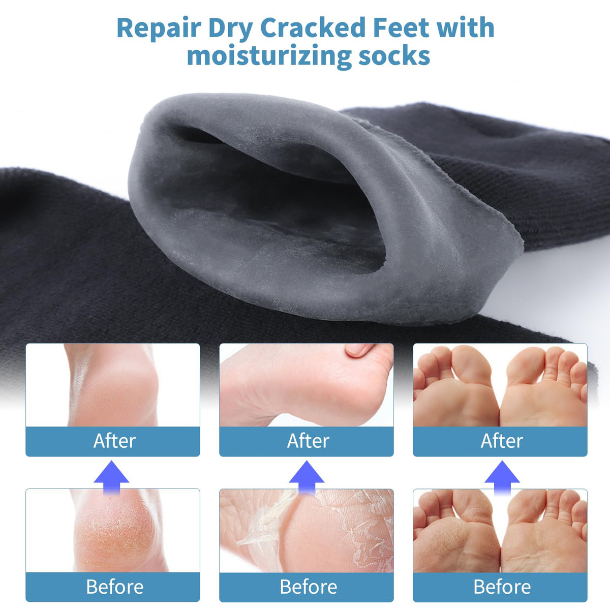 ALUROICE socks on resting feet demonstrating moisturization