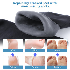 ALUROICE socks on resting feet demonstrating moisturization