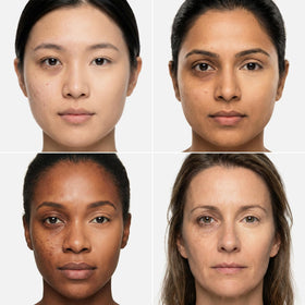 AmazingCosmetics concealer before and after under-eye to show coverage benefit