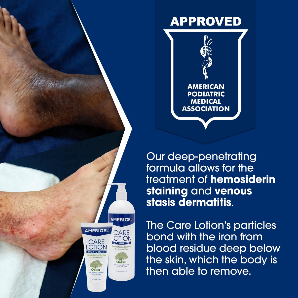 AMERIGEL cream close-up showing smooth texture and fast absorption