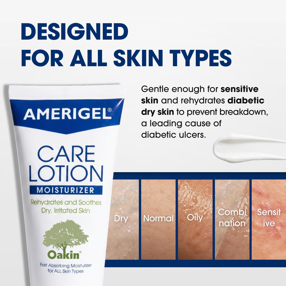 AMERIGEL applied to foot demonstrating soothing relief for heels