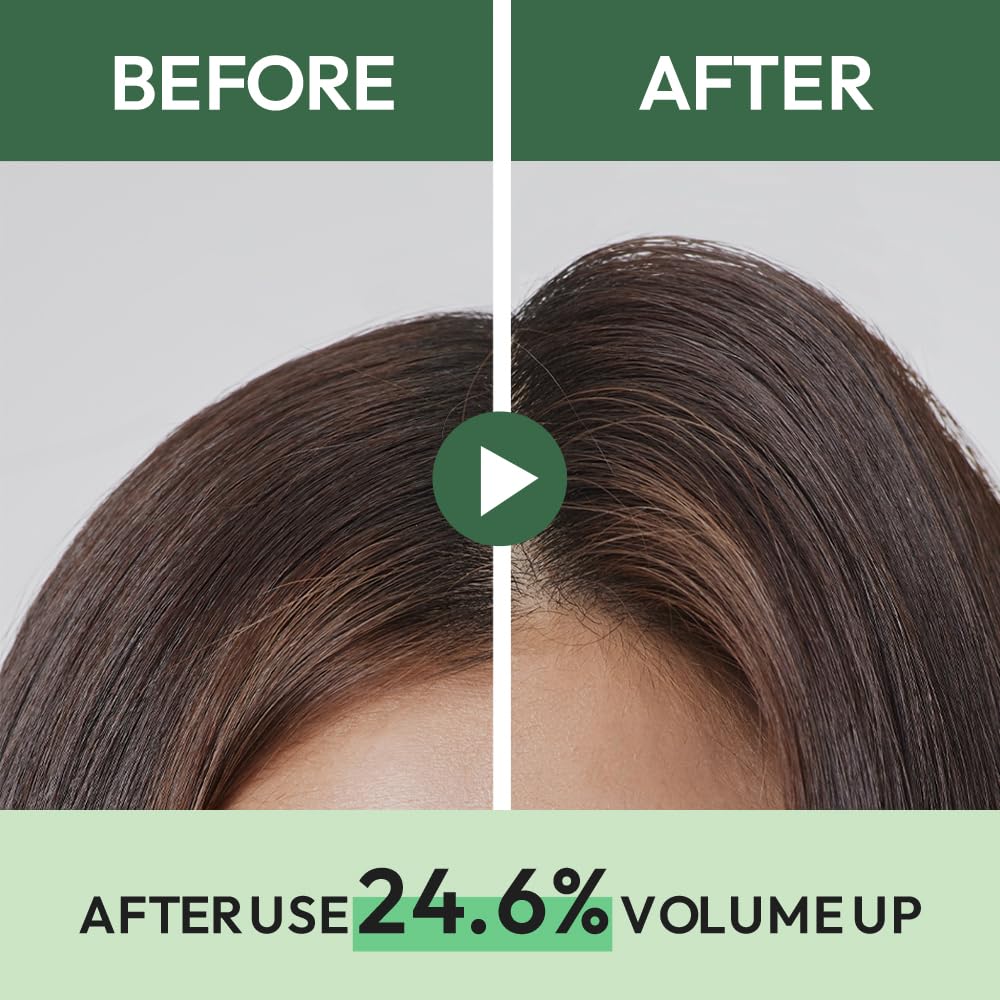 AMOS PROFESSIONAL before and after image showing reduced oily roots and shine