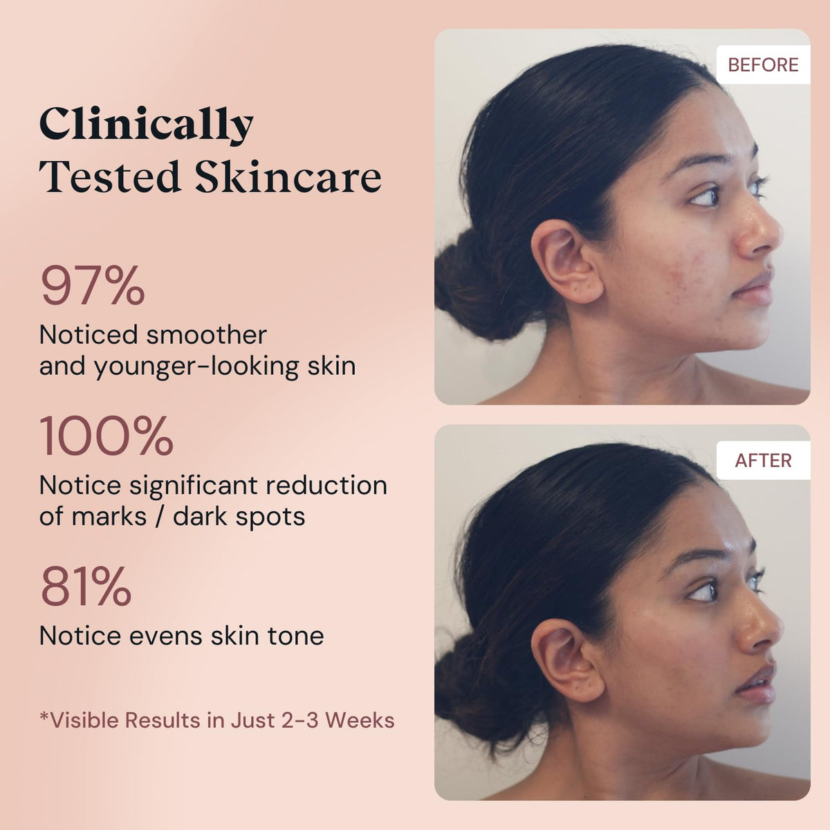 Amour De Moi photographed in a nighttime skincare routine demonstrating ease of use
