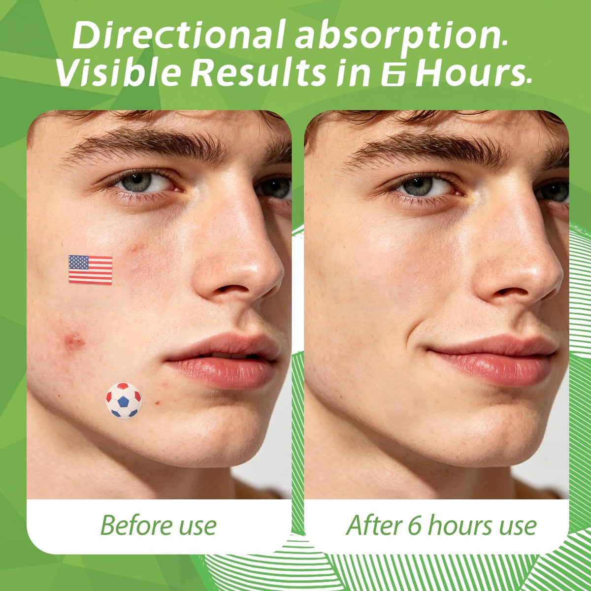 Anchiray before and after nighttime absorption showing reduced visible fluid