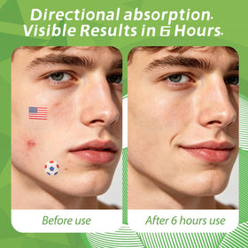 Anchiray before and after nighttime absorption showing reduced visible fluid