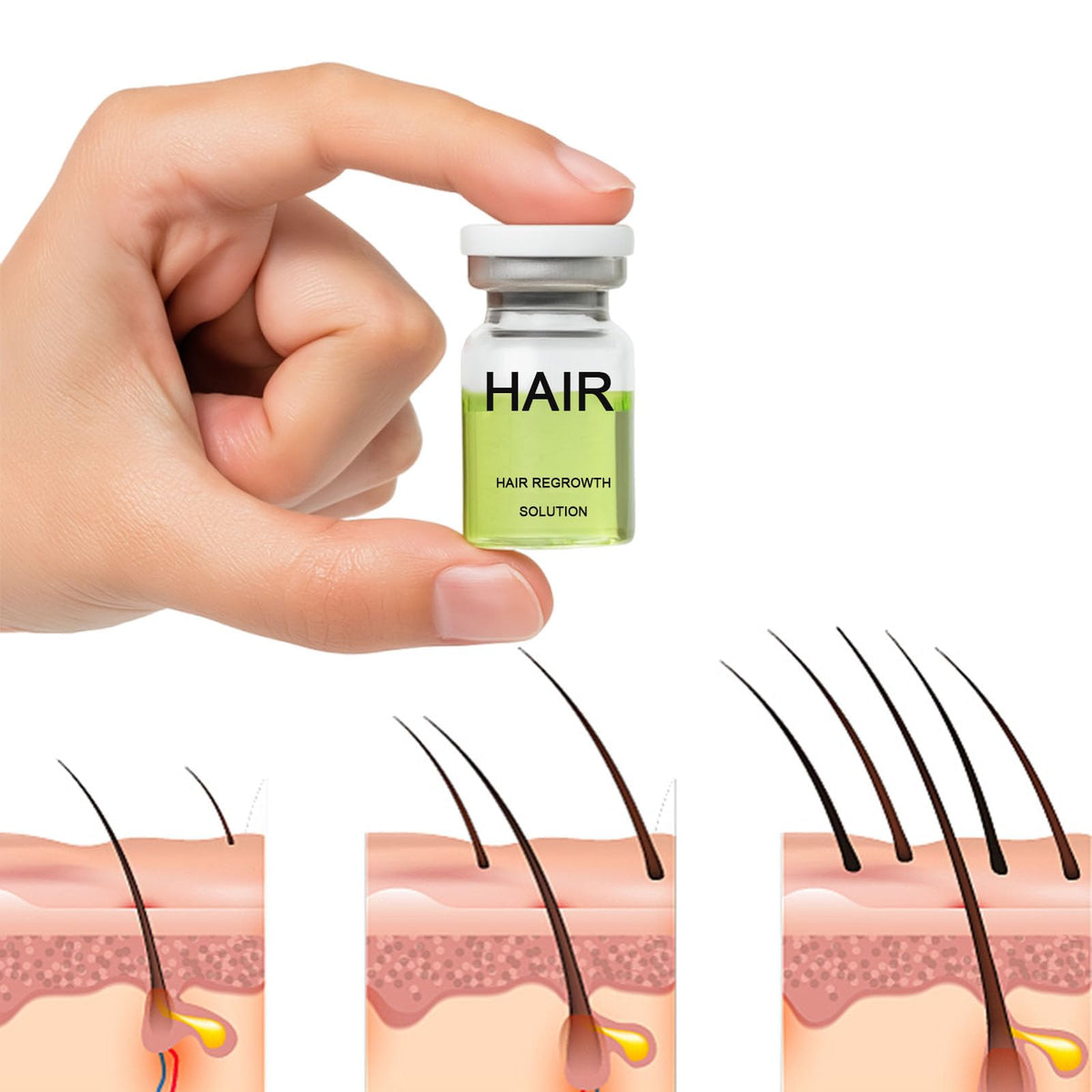 ANEFOSE size and before-after comparison showing improved hair fullness appearance