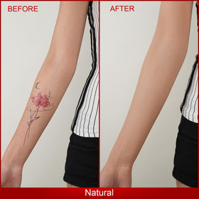 ANJOROUSA before and after concealing a tattoo with seamless results