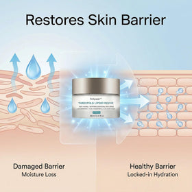Antyoper cream on hand illustrating quick absorption and moisturized skin