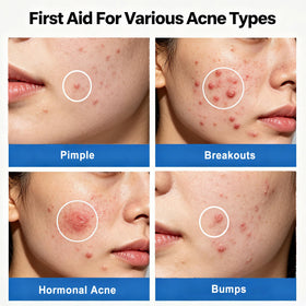 AOAO bi‑phase texture separated into liquid and powder, enables precise spot application
