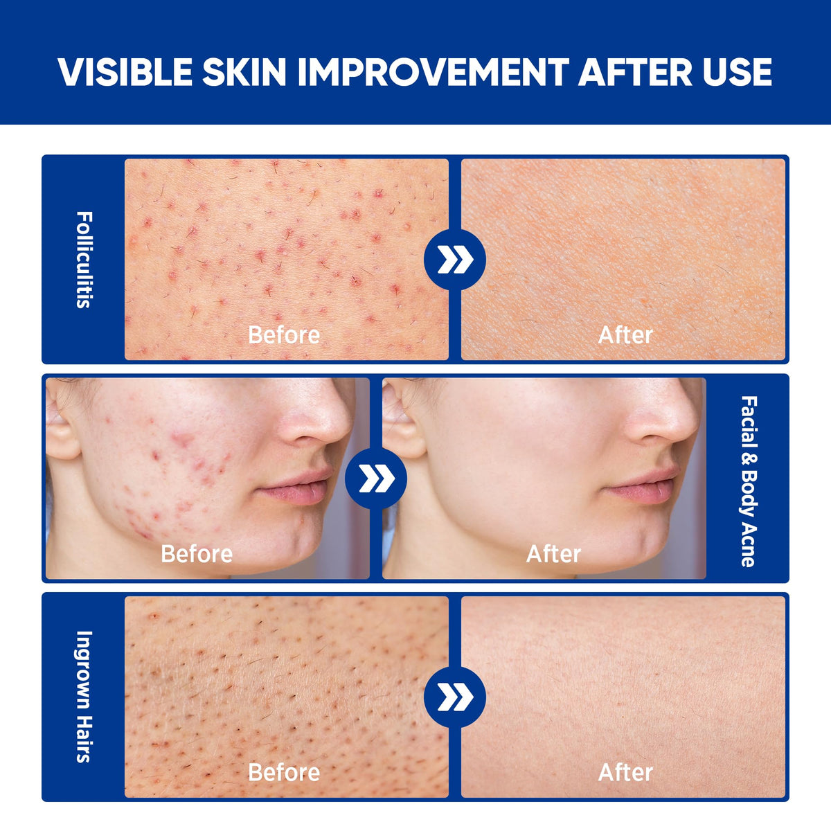 AOSORW application on scalp demonstrating targeted relief and non-greasy finish