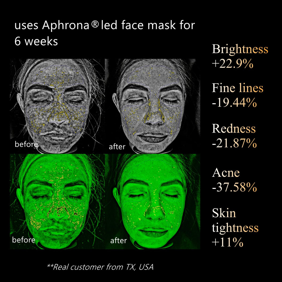 Aphrona Halo see-through eye visor closeup protecting eyes while watching