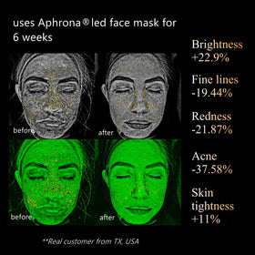 Aphrona Halo see-through eye visor closeup protecting eyes while watching