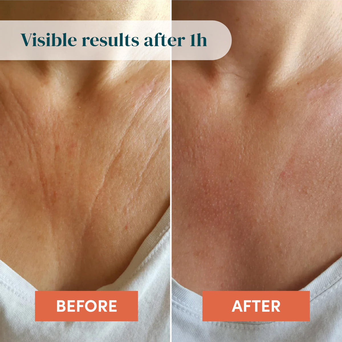 APRICOT liberté décolleté applied to chest demonstrating smoothing effect benefit