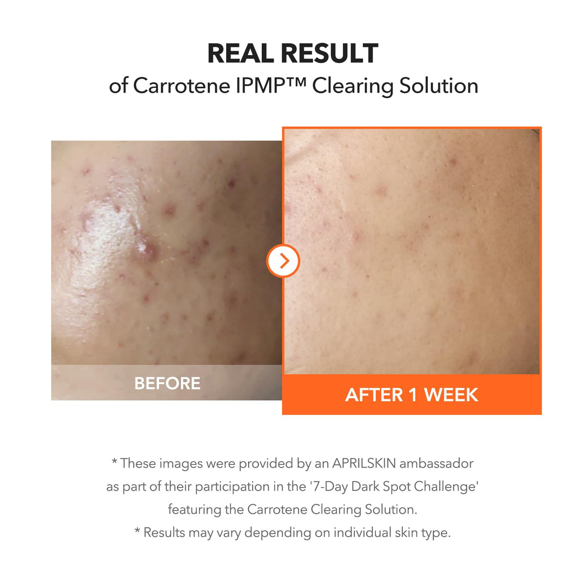 APRILSKIN ingredient label highlighting niacinamide and zinc oxide benefits