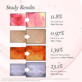 APRILSKIN model showing glass-glow finish and dewy, smooth skin benefit