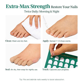 APUREE in use on a toenail demonstrating comfortable shoe-wearing