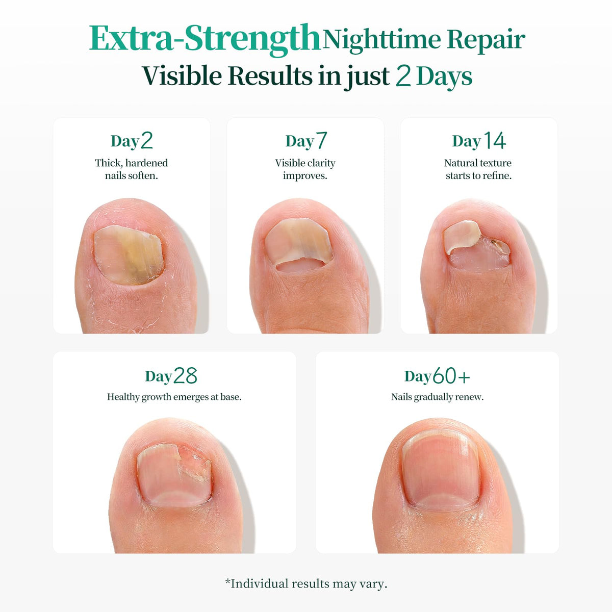 APUREE gently removing patch to show mess-free removal and ease of use