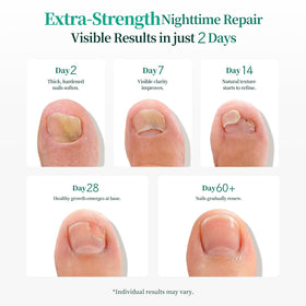 APUREE gently removing patch to show mess-free removal and ease of use