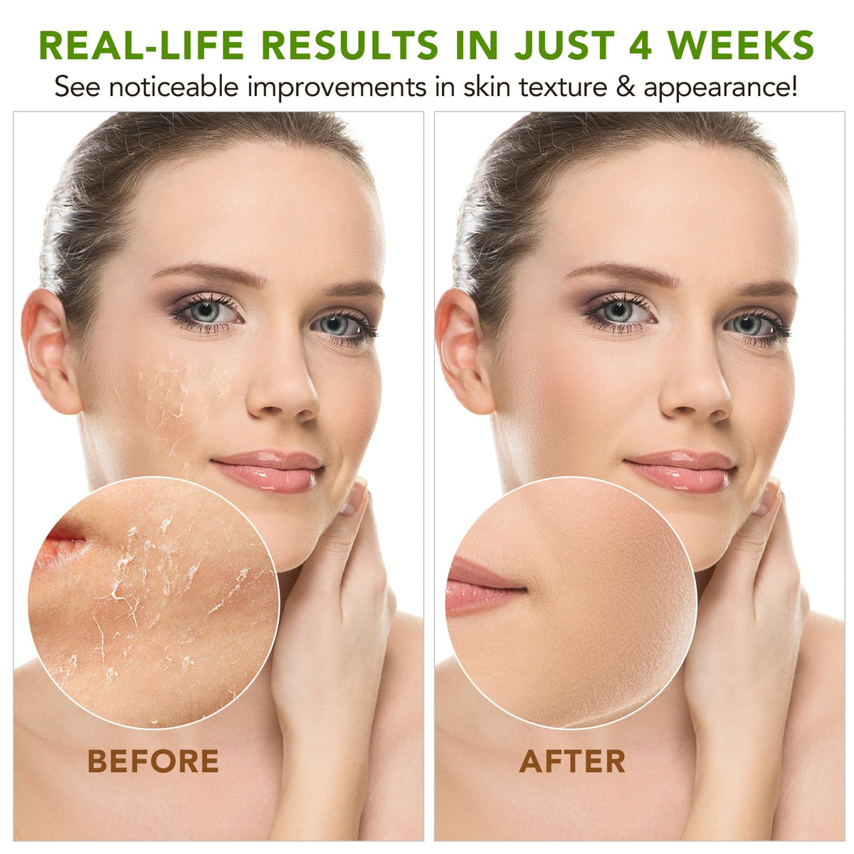 APUUFYQC applied to elbow demonstrating targeted moisturization and softness