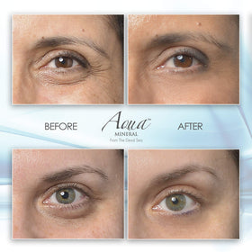 Aqua Mineral gel applied on fingertip demonstrating easy under-eye use