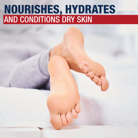 Aquaphor before and after feet showing smoother heel improvement result