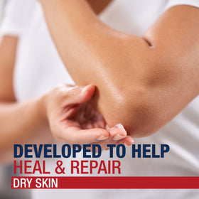 Aquaphor being applied to cracked heels and hands to protect skin