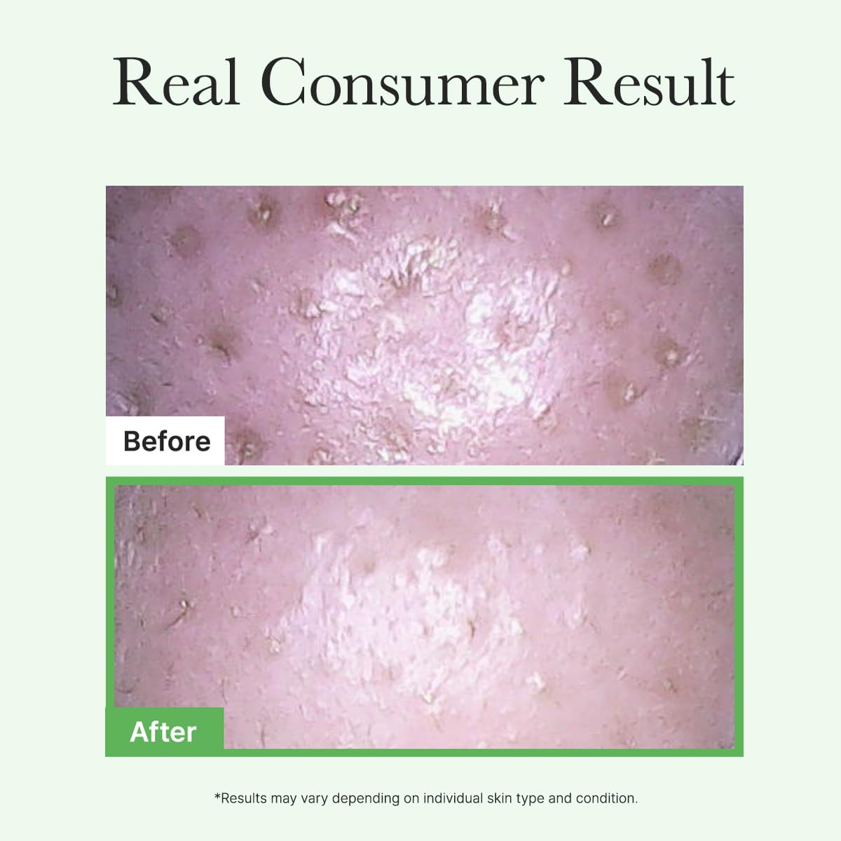ARENCIA applying oil to dry skin, demonstrates effective makeup breakdown