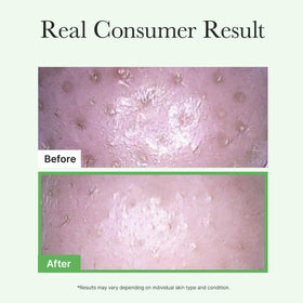 ARENCIA applying oil to dry skin, demonstrates effective makeup breakdown