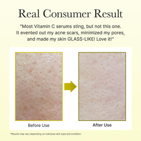 ARENCIA before and after comparison suggesting improved skin clarity