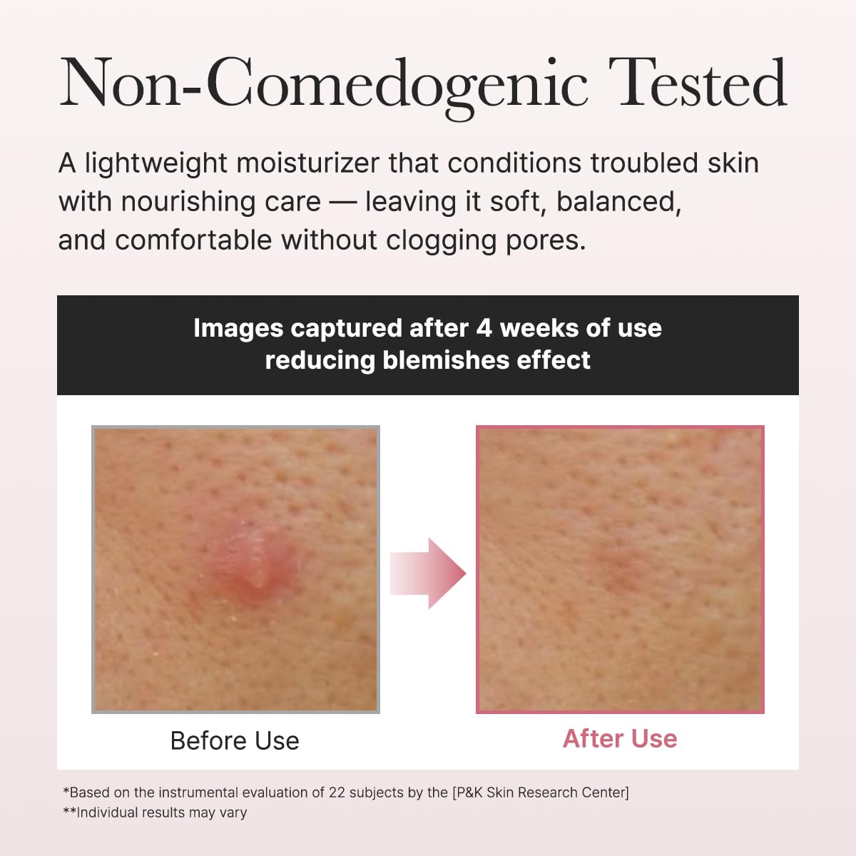 ARENCIA highlighting niacinamide 5% for smoother-looking skin