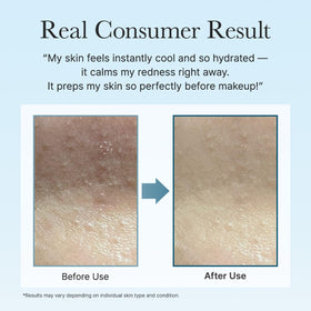 ARENCIA pad application on face demonstrating quick soothing and hydration