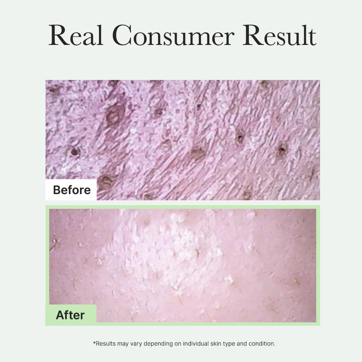 ARENCIA scrub applied to cheek demonstrating gentle cleansing action