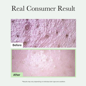 ARENCIA scrub applied to cheek demonstrating gentle cleansing action