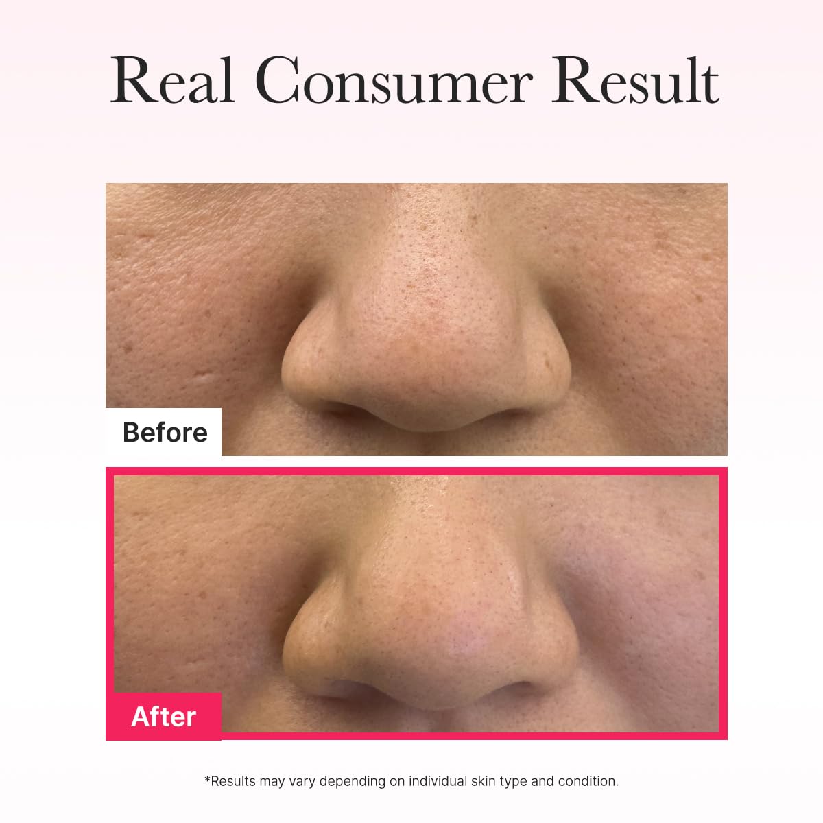 ARENCIA serum residue after removal illustrating absorbed, non-greasy benefit